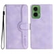 thumbnail image 2 of Funda FOXDOCK para Motorola MOTO G35 -Diseño elegante,Ideal para hombres y mujeres, 2 of 5