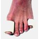 thumbnail image 3 of Almohadillas para pies Dr. Jill's Tubefoam, 16 unidades, tamaño grande Y1855, 3 of 8