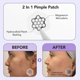 thumbnail image 5 of Parche antiacné FreeGo de magnesio con microdardos – Grande, 12 unidades, 5 of 8