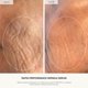 thumbnail image 3 of Suero facial U Beauty 30 ml con péptidos de cobre, 3 of 8