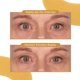 thumbnail image 4 of Parche para ojos Dr. Tree 84 g / 2,96 oz (60 almohadillas), 4 of 9