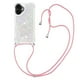 thumbnail image 4 of Funda FOXDOCK para iPhone 17 con Cuerda Ajustable, Brillo Líquido, Protección Antigolpes y Lente – Ideal para Regalo, 4 of 6