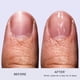 thumbnail image 3 of Fortalecedor De Uñas Nail Envy Clear Para Uñas Débiles Y Delgadas, 3 of 8
