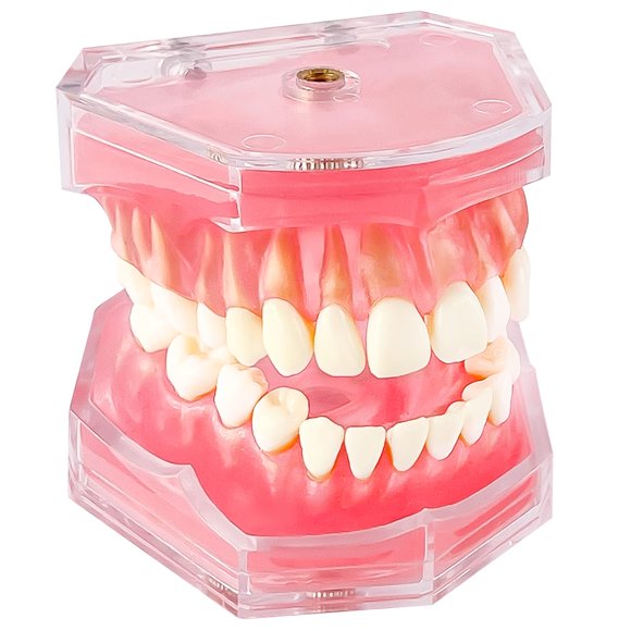 Modelo dental Ceonam de dientes extraíbles con encía de silicona