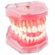 thumbnail image 1 of Modelo dental Ceonam de dientes extraíbles con encía de silicona, 1 of 8
