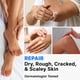 thumbnail image 3 of Set Crema 40% Urea 130 G Y Fungus Master 30 Ml, 3 of 3