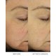 thumbnail image 4 of Hidratante Facial Noble Panacea 30 Dosis, 4 of 9