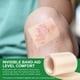 thumbnail image 4 of Rollo hidrocoloide para el cuidado de heridas RSGRT cortado a medida de 1,5 m, 4 of 9