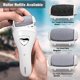 thumbnail image 3 of Electric Foot Callus Remover, Rechargeable Foot File for Dead Skin, 3 of 3