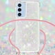 thumbnail image 3 of Funda FOXDOCK para Samsung Galaxy A26 5G con Cuerda Ajustable, Brillo Líquido, Protección Antigolpes y Lente – Ideal para Regalo, 3 of 6