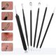 thumbnail image 2 of Kit extractor de puntos negros Tomata de acero inoxidable, 2 of 3