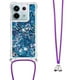 thumbnail image 1 of Funda FOXDOCK para Xiaomi Redmi Note 13 Pro 5G con Cuerda Ajustable, Brillo Líquido, Protección Antigolpes y Lente – Ideal para Regalo, 1 of 6