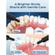 thumbnail image 2 of Ultrasonic Plaque Remover for Teeth Dental Tartar Remover, 2 of 3