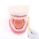 thumbnail image 2 of Modelo de cuidado dental: modelo de boca RONTEN agrandado 6x, 2 of 7