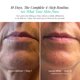 thumbnail image 2 of Suero Facial FU Beauty Kit 4 Pasos – Reto de 10 Días, 2 of 7