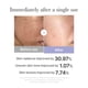 thumbnail image 3 of Herramienta para el cuidado de la piel facial medicube Mini Booster Pro Pink, 3 of 3