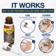 thumbnail image 4 of Tratamiento para uñas encarnadas URIEL UPGRADE 20 ml, 4 of 9