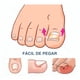 thumbnail image 2 of Pack 100 Parches Correctores De Uña Encarnados, 2 of 3