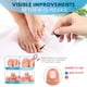 thumbnail image 5 of Tratamiento Para Hongos En Las Uñas De Los Pies Extra Strength, 5 of 7
