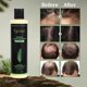 thumbnail image 3 of Shampoo Tgideas Rosemary Biotin Keratina Volumen Anticaída, 3 of 3