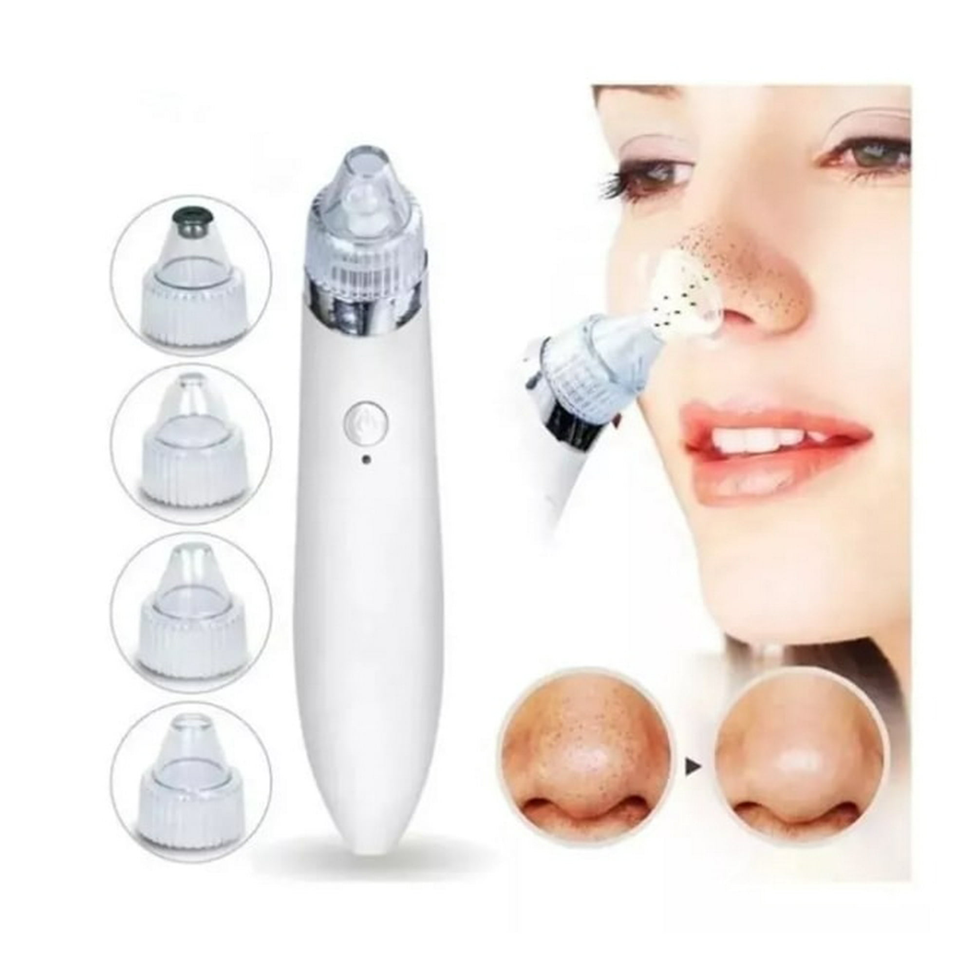 Factorynet - Removedor Extractor Puntos Negros Espinillas Y Limpia Poros