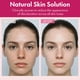 thumbnail image 5 of Crema Facial Roseblem con 7% Arbutina y Ácido Tranexámico 50 g, 5 of 9