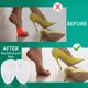 thumbnail image 3 of Inserto para Zapatos Comfwalk StepEase Gel - 2 Pares, 3 of 8
