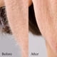 thumbnail image 4 of Kit de reemplazo de dermaplaning Michael Todd Sonicsmooth Pro+, 4 of 7