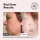 thumbnail image 3 of Crema facial MEDI LIFT 25 g Colágeno y Ácido Hialurónico, 3 of 8