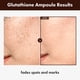 thumbnail image 2 of Sérum TOSOWOONG Glutatión 30 ml con niacinamida y ácido hialurónico, 2 of 6