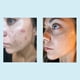 thumbnail image 4 of Chemical Peel Perfect Image con ácido glicólico 30% con retinol, 30 ml, 4 of 9