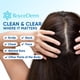 thumbnail image 4 of Sérum calmante para piel seborreica y psoriasis Roycederm para cuero cabelludo, 4 of 8