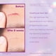 thumbnail image 5 of Gel para cicatrices Cicatricure para rostro y cuerpo, 30 ml (1 oz), paquete de 2, 5 of 6