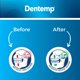 thumbnail image 3 of Protector dental Dentemp Ora-Guard personalizado para rechinar los dientes, 3 of 3