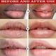 thumbnail image 2 of Remove Dark Lip Balm Lightening Melanin Mask Gloss Oil Exfoliating Clean Moisturizer Korean Care Products Makeup Beauty Health, 2 of 3