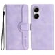 thumbnail image 1 of Funda FOXDOCK para Xiaomi POCO X7 Pro -Diseño elegante,Ideal para hombres y mujeres, 1 of 5