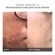 thumbnail image 5 of Crema hidratante PHYLA 50 ml con niacinamida anti-manchas, 5 of 8