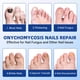 thumbnail image 4 of Parches para uñas con hongos JOYJAR Extra Strength, 21 parches, 4 of 6