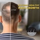 thumbnail image 2 of Sérum para el crecimiento del cabello Yanzisno1 5% Minoxidil para hombres y mujeres, 2 of 3