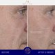 thumbnail image 3 of Suero facial Augustinus Bader 15 ml, 3 of 9