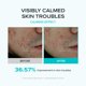 thumbnail image 4 of Suero Facial SKIN & LAB Ácido Azelaico 10% 30 ml, 4 of 8