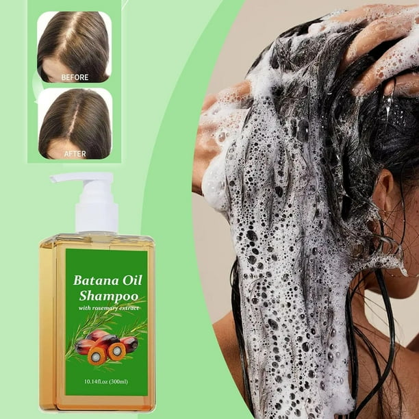 Champú Batana Oil para el crecimiento del cabello con biotina 9 en 1, 300  ml | Lider