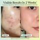 thumbnail image 4 of Serum KraveBeauty Great Barrier Relief, paquete de 2 unidades, 45 ml, 4 of 9