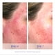 thumbnail image 4 of Sérum iS Clinical Pro-Heal Advance+ con vitamina C, E, 15 ml, 4 of 6