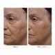 thumbnail image 4 of Borrador Wrinkle Lost Line Reducer Dr. Denese de 3 minutos, 4 of 4