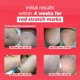 thumbnail image 5 of Crema eliminadora de estrías Cicatrissim Red para todo tipo de piel, 5 of 8