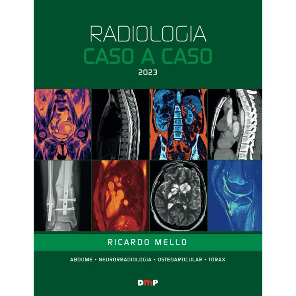 Libro DMP Radiología Caso a Caso 2023 (Portugués)
