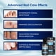 thumbnail image 3 of Tratamiento de hongos OSIMOON Extra Strength para uñas de los pies, 2 paquetes, 3 of 7