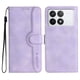 thumbnail image 1 of Funda FOXDOCK para Xiaomi Poco X6 Pro -Diseño elegante,Ideal para hombres y mujeres, 1 of 5