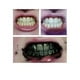thumbnail image 2 of Crema Pasta Dental Blanqueadora Carbon Miracle Teeth 20grs, 2 of 2
